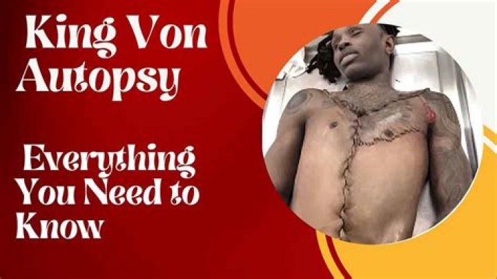 Unraveling The Mystery: King Von Autopsy Explained